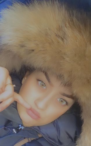 Customer photo review of Jubby Green Contact Lenses(12 months wear)