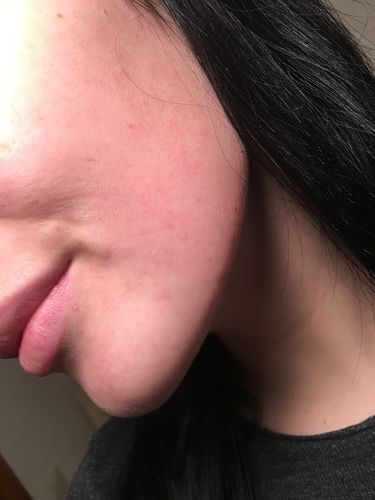 Customer photo review of GLOW DUOs