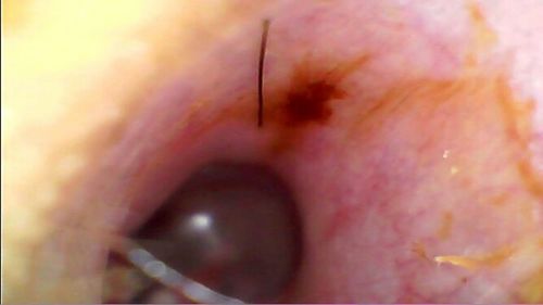 Customer photo review of Waxy Scrappy