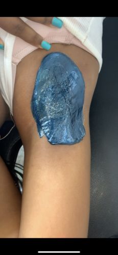 Customer photo review of Pro Series Hair Removal Wax