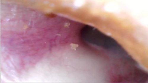 Customer photo review of Waxy Scrappy