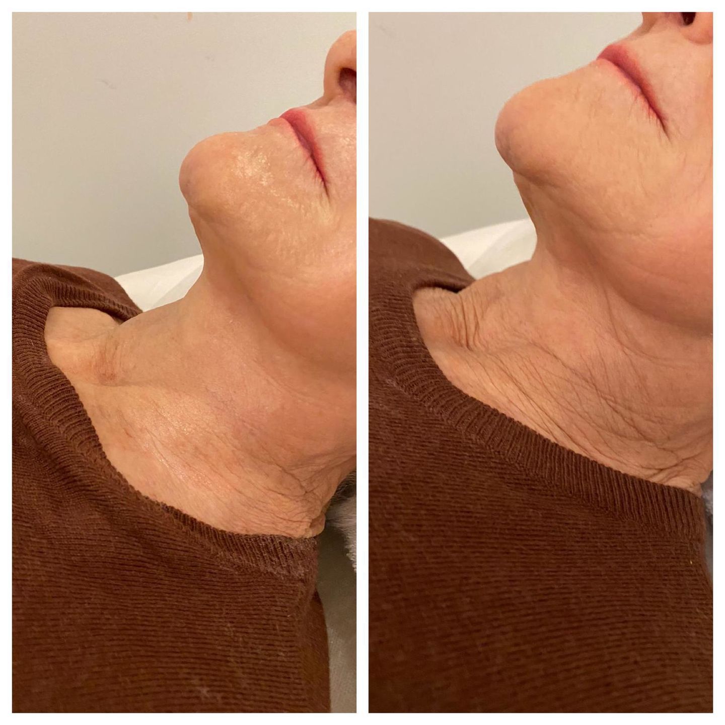 Recensione con foto di un cliente su SYNERGY FACE