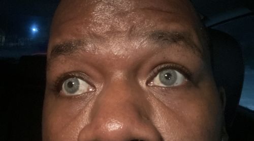 Customer photo review of SL70 Gray Contact Lenses(12 months wear)