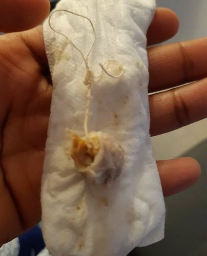 Customer photo review of SUBLIM-PERLE (applicateur en option)