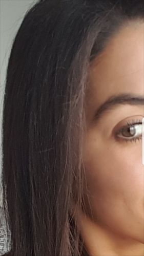 Customer photo review of Acne set