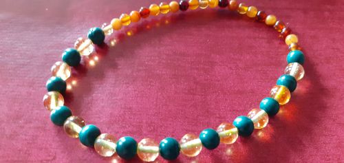 Customer photo review of BRACELET TRIO ANTI DOULEUR