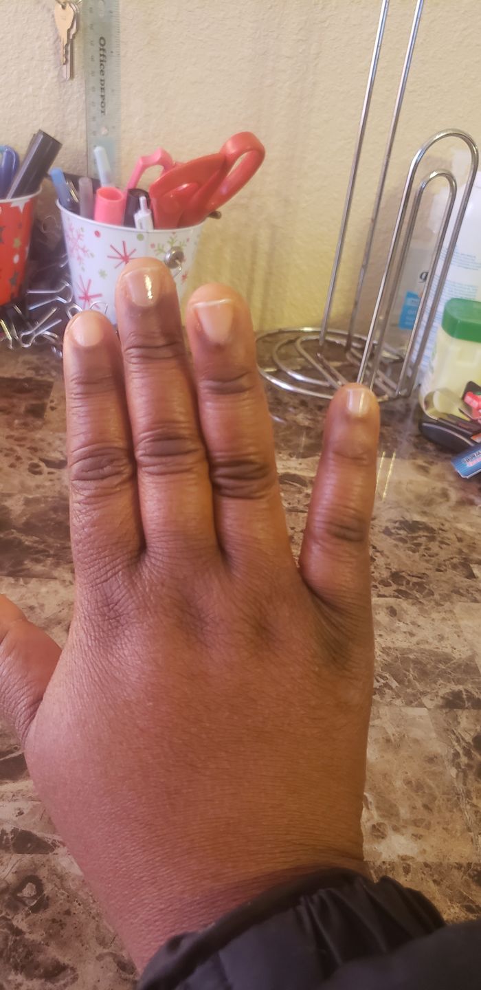Customer photo review of Fair and White Original Body Clearing Milk Lotion 500 ml / 16.90 fl oz