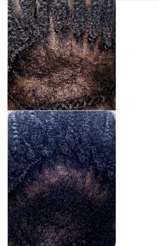 Customer photo review of Chad and India’s Root to Tip Bundle| 3 sizes to choose from