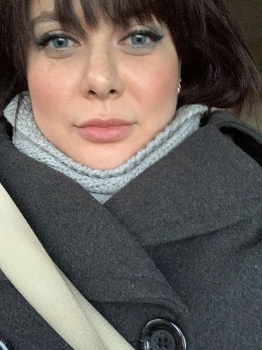 Customer photo review of SL70 Blue Contact Lenses(12 months wear)