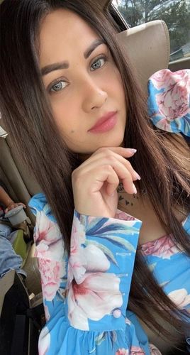 Customer photo review of SL70 Gray Contact Lenses(12 months wear)