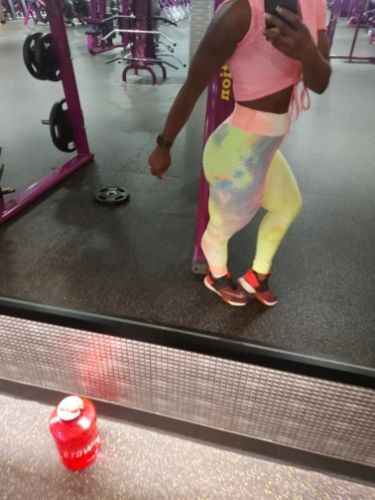 Customer photo review of GYMKARTEL® ANTI-CELLULITE AND PUSH UP LEGGINGS - TIE-DYE YELLOW