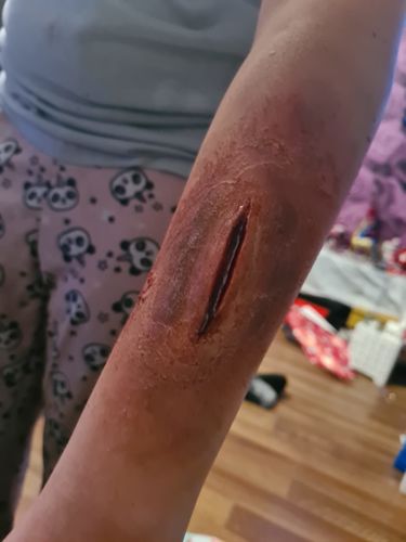 Customer photo review of Ben Nye Basic Moulage Special FX Makeup Training Kit