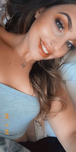 Customer photo review of Teeth Whitening Kit