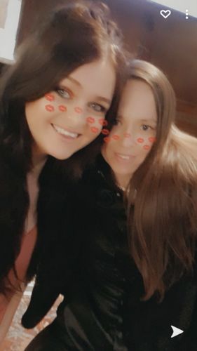 Customer photo review of Teeth Whitening Kit