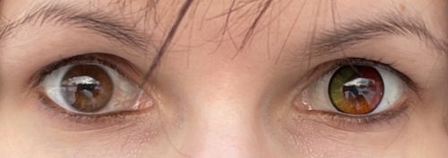 Customer photo review of Unicorn Contact Lenses