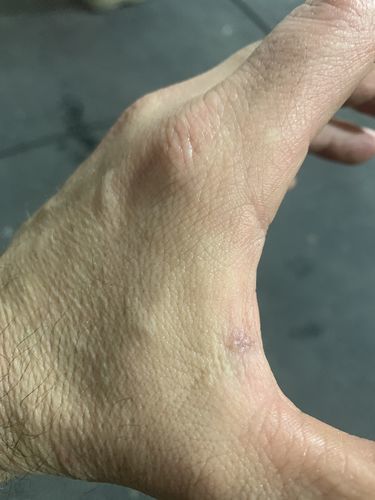 Customer photo review of Combat Ready Ointment - Triple Threat