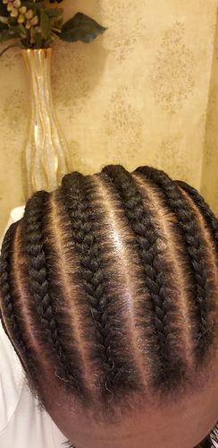 Customer photo review of (30%off) REGROWTH Hair Serum (BEST SELLER)