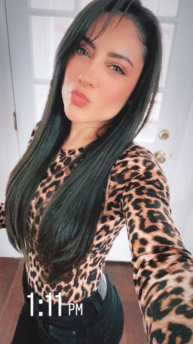 Customer photo review of Norko Green Contact Lenses(12 months wear)