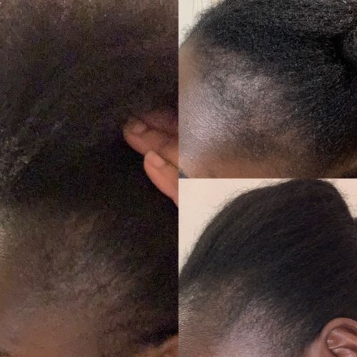 Customer photo review of Inches - Hair & Beard Growth Oil