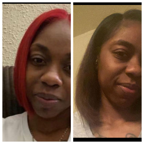 Customer photo review of REGROWTH Hair Serum (BEST SELLER)