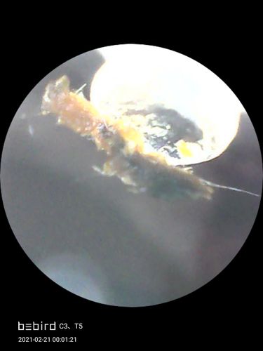 Customer photo review of Bee Gone Wax Ear Cleaner