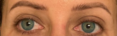 Customer photo review of [US Warehouse] Polar Lights Blue Prescription Contact Lenses