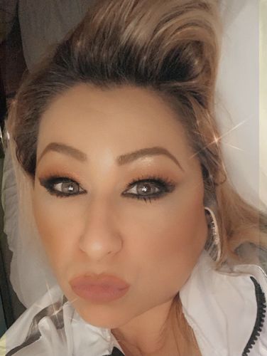 Customer photo review of Neala Brown Contact Lenses(12 months wear)