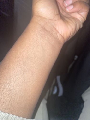 Customer photo review of Fair and White So White Hydra Sweet Moisturizing Body Lotion with Sweet Almond Oil 500ml/ 16.90 fl oz