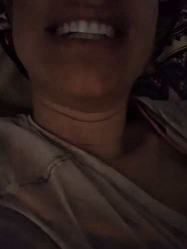 Customer photo review of Night Guard