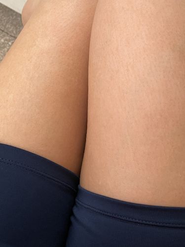 Customer photo review of Self Tanning Mousse