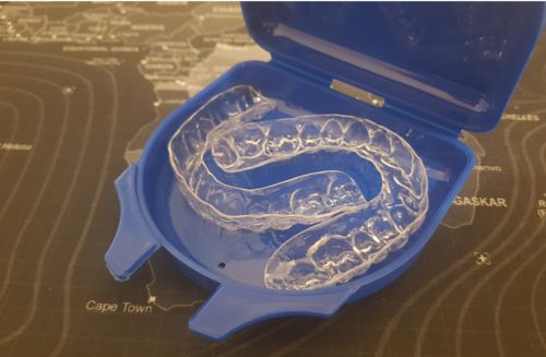 Customer photo review of SleepPro Retainers