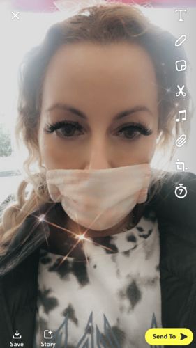 Customer photo review of Eyra Brown Contact Lenses(12 months wear)