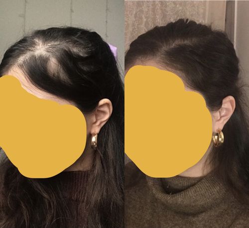 Customer photo review of Growth & Shine Hair Oil