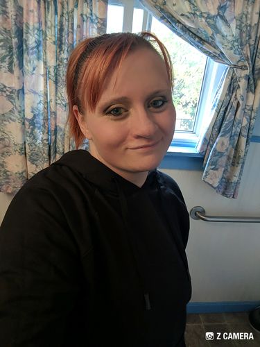 Customer photo review of Neala Pink Contact Lenses(12 months wear)