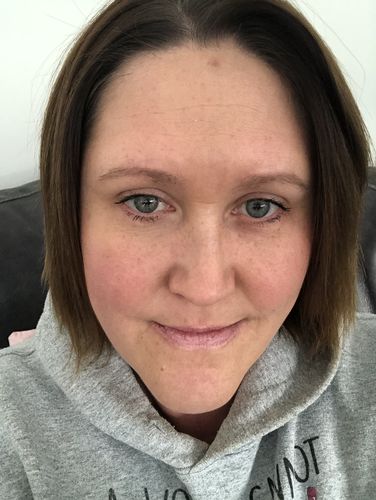 Customer photo review of Rosalique 3 in 1 Anti-Redness Miracle Formula SPF50