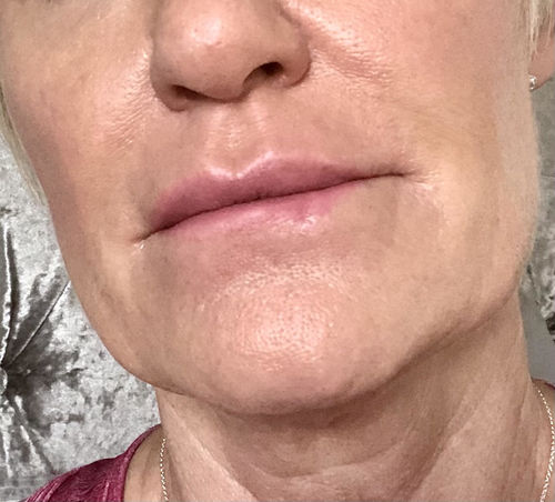 Customer photo review of Repair and Renew Cream