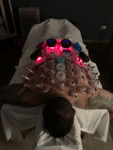 Customer photo review of Achedaway Cupper - The Smart Cupping Therapy Massager