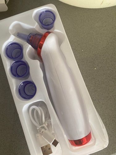 Customer photo review of Ultrasonisk Blackhead Ekstraktor