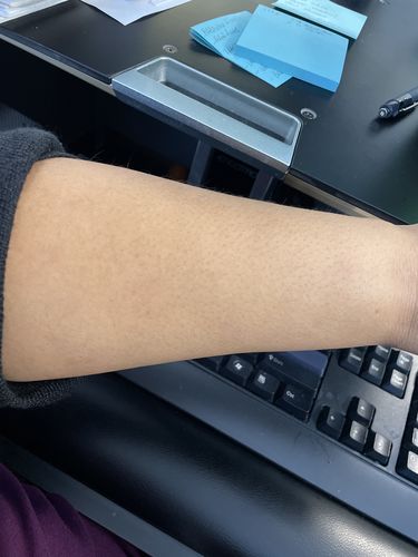 Customer photo review of CurlMix Fresh Quarterly Kit - On Hold Indefinitely