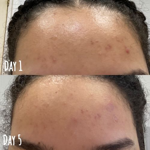 Customer photo review of Oats & Honey Face & Body Soap Bar
