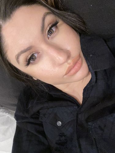 Customer photo review of Neala Brown Contact Lenses(12 months wear)