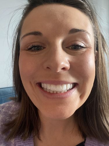 Customer photo review of SleepPro Night Guard Range