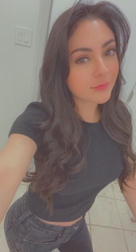 Customer photo review of SL29 Brown Contact Lenses(12 months wear)