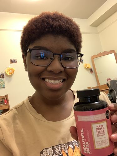Customer photo review of BEAUTIFUL SISTA - Hair Skin & Nails Advanced Formula Tablet (45 Day Supply/ .64 Cent A Day) CLICK HERE