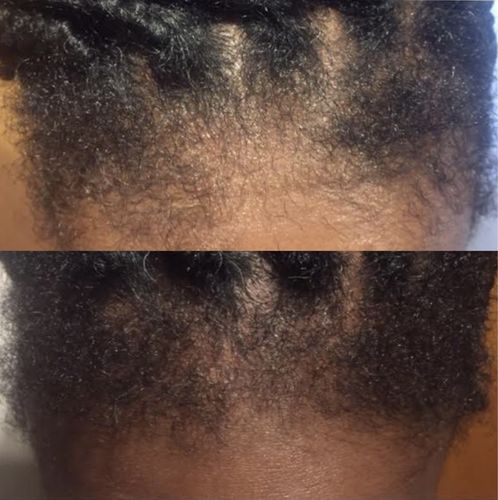 Customer photo review of Inches - Hair & Beard Oil