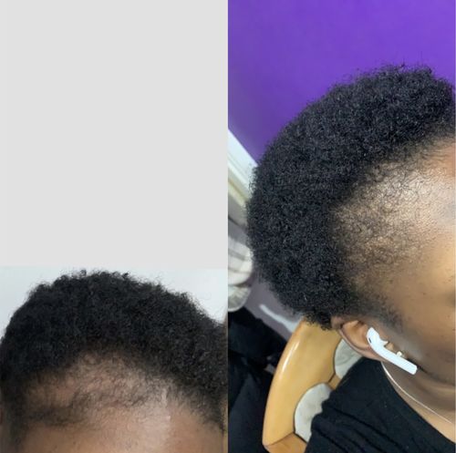 Customer photo review of Native