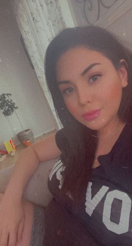 Customer photo review of SL29 Green Contact Lenses(12 months wear)