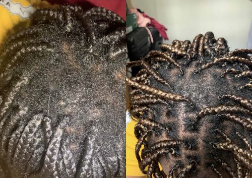 Customer photo review of Native