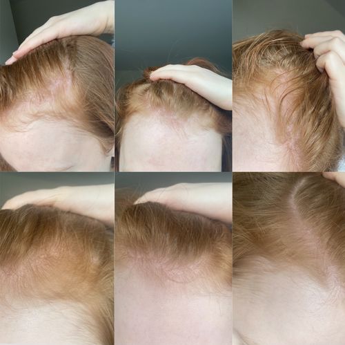 Customer photo review of Inches - Hair & Beard Oil