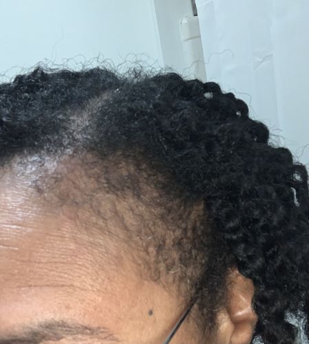 Customer photo review of Hair Growth Serum